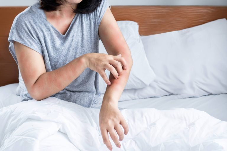 Ακάρεα: Πώς να Απαλλαγείς Από τους Αόρατους Εχθρούς στο Σπίτι 2 akarea allergies